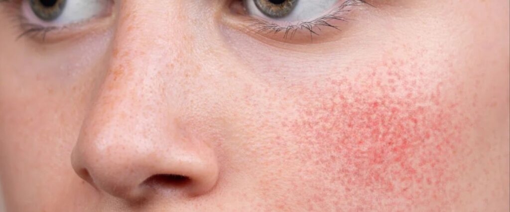 Encuentran bacterias y materiales tóxicos en maquillajes