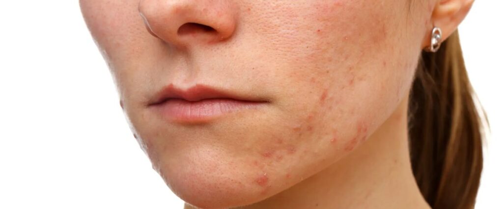 Maquillaje chino contaminado con bacterias y materiales tóxicos